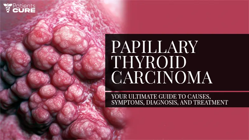 Papillary Thyroid Carcinoma: Guide to Causes, Symptoms, Treatment