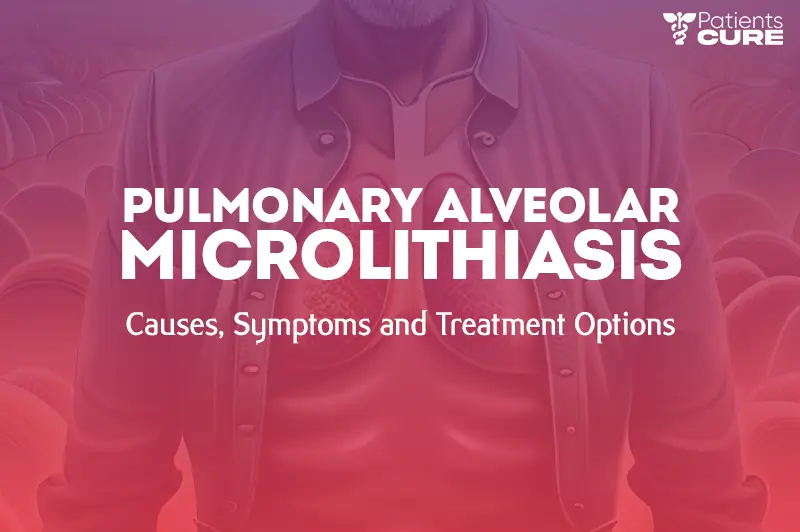 Pulmonary Alveolar Microlithiasis: Symptoms, Causes, Diagnosis & Treatment